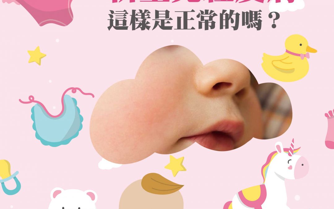 新生兒紅皮膚？這樣是正常的嗎？